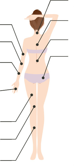 全身脱毛コース 背面