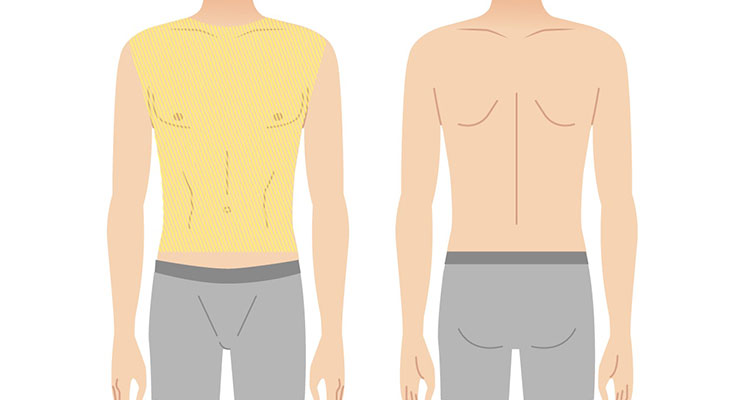 パーツ別脱毛 医療脱毛ならカレイドクリニック 横浜駅すぐ